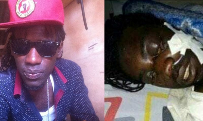 Bobi Wine’s People Power Supporter Abducted, Eye Plucked Out