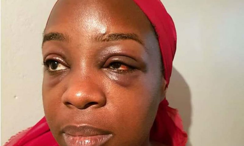 Chicken Tonight Security Guard Earns Self One Year Jail Term For Assaulting Musician Angella Katatumba