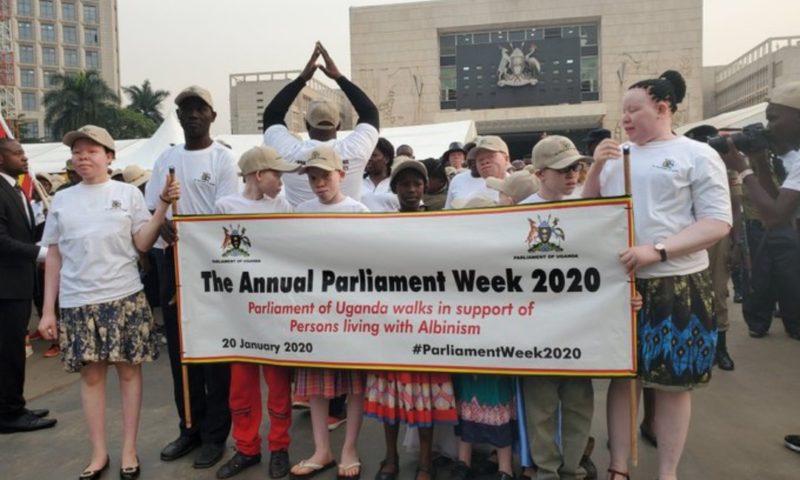 Parliament To Construct Rehabilitation Center For Persons With Albinism
