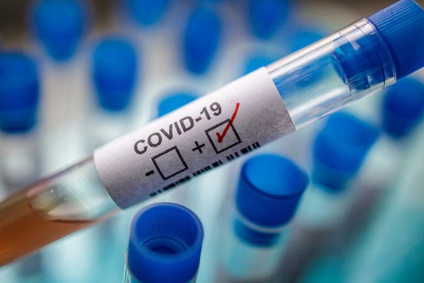 Uganda’s COVID-19 Cases Rise To 1075 As Global Tally Nears 15 Million