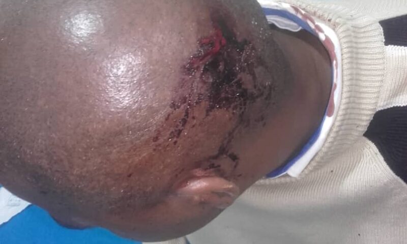School Director Cheats Death By Whisker After Iron-Bar Hit Squad Attack At Shoprite