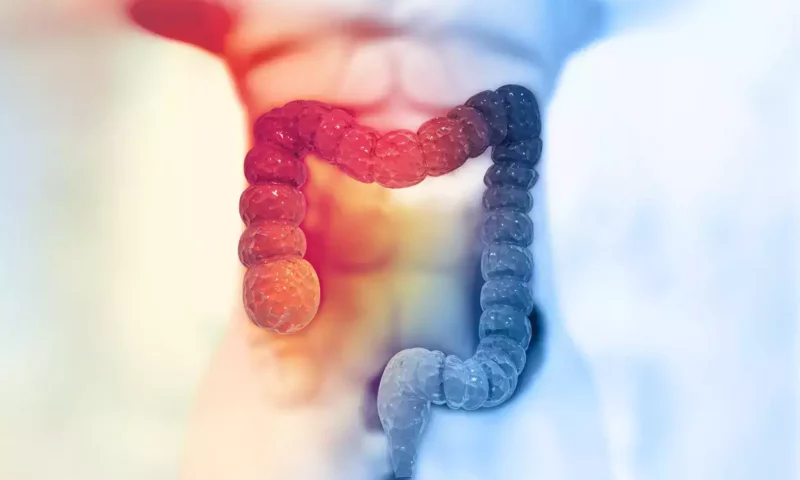 Health Alert: These 4 Symptoms Are Red Flags For Early-Onset Colorectal Cancer